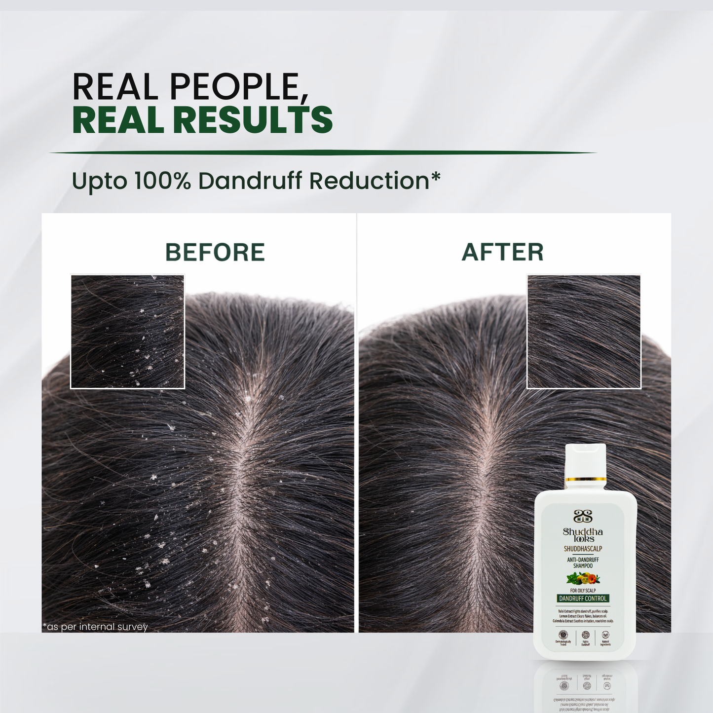 Shuddhalooks Anti-Dandruff Shampoo