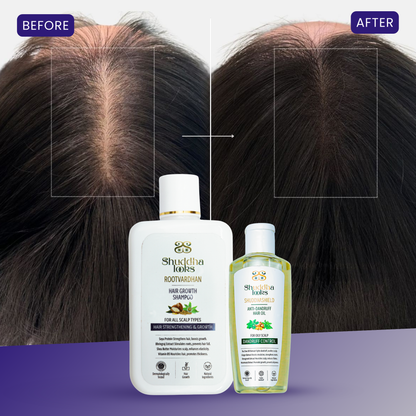 Hair growth  shampoo +  Dandruff oil