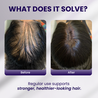 Dandruff  shampoo + Hair  growth oil