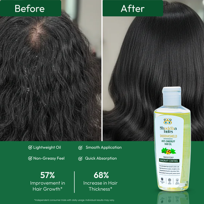 Dandruff Preventing Hair Oil